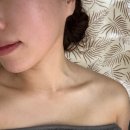 초이스메디 | 광주 수완지구 웨딩관리 365메디스킨