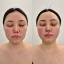 신광빌딩 | 인천 피부관리 금손테라피 내돈내산 3번째 방문 후기