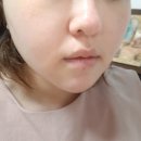 하비애터미 | 애터미 앱솔루트 4개월의 변화 피부좋아지는 법 꿀팁