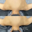 평택바디관리 모은에스테틱 등슬림레이션 결혼 전 예신케어 후기
