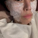 안*진 - 미추홀구 소성로 120 | 강남 세르프 레이저리프팅으로 티 안 나게 어려진 리얼 후기(+앞볼,옆볼필러)