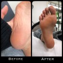 영헬스사우나 | 화명동 발각질제거 추천 ㅣ 영네일&amp;오로지푸스 부산북구점 찐솔직후기