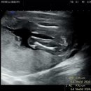 아뮤고나 이미지