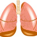 조기 발견 어려운 폐암 체크리스트 10﻿ 이미지