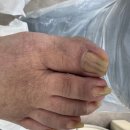 레푸스앤두두뷰티 | 파고드는 발톱 걱정 끝! 의정부레푸스 <레푸스 앤 두두뷰티> 만족 리뷰