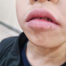 나자로약국 네이버블로그