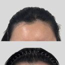 도트바이림 | 대전 두피관리 헤어라인문신 꼼꼼하고 자연스럽게 채워주는 도트바이림 후기