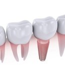 리빙웰치과병원 이미지