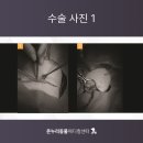 늑골집 이미지