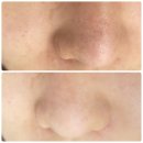 이마트에브리데이 매탄동점 | [수원매탄동 피부관리] '미다온뷰티' 아기피부되고온 찐후기 꼼꼼하고 친절한 매탄동피부샵 (๑･ิ◡･ิ๑)