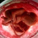 실제 9개월된 태아의 자궁내 모습 이미지