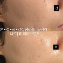 나주 피부관리 <리리아브로우> 세라링 후기💛