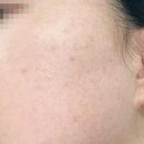 힐비뇨기과의원 이미지