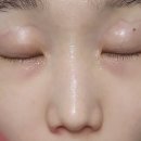 JS메디컬센터(블랙야크건물) | 울산 삼산 피부관리 데자뷰메디스킨 탄력관리