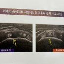 콕콕마취통증의학과의원 티스토리