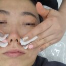 광주북구 미백&amp;기미관리 맛집 아임뷰티