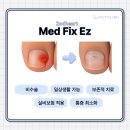 사랑의손길마취통증의학과의원 | 광진구 능동 러닝 후 발가락 통증, 수술 없이 가능한 비수술 내성발톱 교정기 치료 추천!