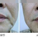 웰빙비뇨기과 네이버블로그