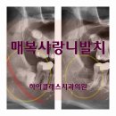장유뉴욕치과병원 | 대학병원 사랑니발치 가능한 장유 치과