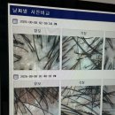 씨유하남8번로점 | 하남탈모 관리 탑스칼프 하남미사점 미사두피관리 후기