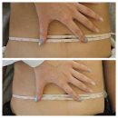 라라샵까치산역점 | [까치산역 에스테틱] 라라샵 까치산역점 - 복부관리로 1.1cm 허리둘레 줄어든 후기