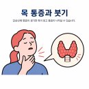 마곡스카이내과의원 | 증상인 목이 붓고,불편한 느낌 지속적으로 있다면 진단 방법과 관리 세종스카이내과에서 알려드립니다.