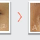 앤써성형외과의원 이미지