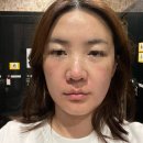 아비쥬의원부평 이미지