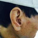 강북독일보청기 이미지