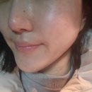 블링에스스킨케어