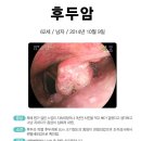셀빙강내과의원 네이버블로그