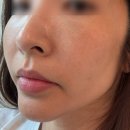 서면 디앤톡스 내돈내산 후기 l 부산 피부과 스킨부스터 수면 케어 리얼후기