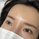 아띠브로우