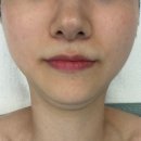 청담스킨앤바디 | 풍무동 피부관리 청담스킨앤바디 윤곽관리 받고 얼굴선 정리한 후기