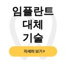임플란트 대체 기술 3D 구강스캐너로 수술없이! 휴먼브릿지 후기 - dentalist
