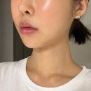 은평아이디의원 | 연신내역피부과 아이디클리닉은평점 울쎄라후기 효과는?