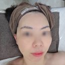 혁신1로 | 김천 피부관리 추천 진앤뷰티 진로열물광+V라인 패키지에 눈밑지방 관리 후기