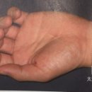 태연한의원 네이버블로그