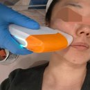 힐링유니버스 | 부산 슈링크 유니버스 500샷 후기 l 턱선리프팅 효과본 리뷰