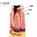 에스제이바른이치과의원 | 중계동치과에서 안내해 드리는 정기검진이 치아 수명을 좌우하는 이유