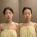 오월 | 광주 신부관리 피부관리 온다 리프팅 오월에스테틱 솔직후기