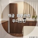 씨유개금스마트점 | 부산 웨딩드레스 입기전 등드름 바디트러블관리 후기 우디스킨