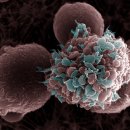 건강 해치는 고지방 식단, 유방암에 더욱 위험한 이유 이미지