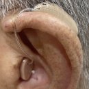 수원보청기 이미지