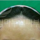 임마누엘헤어 이미지