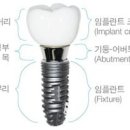 한규돈치과 네이버블로그