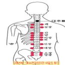 부항요법의 이해와 시술 방법 이미지