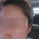 희헤어라인 이미지