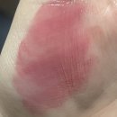 어뮤즈핏 이미지