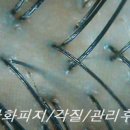 닥터포헤어안산 이미지